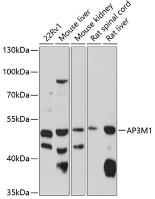100UL AP3M1 ANTIBODY 100 ul