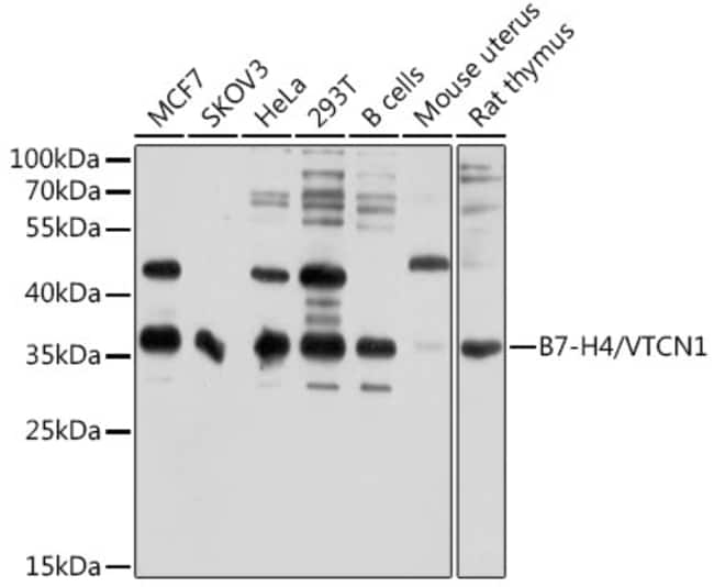100UL B7-H4 ANTIBODY 100 ul