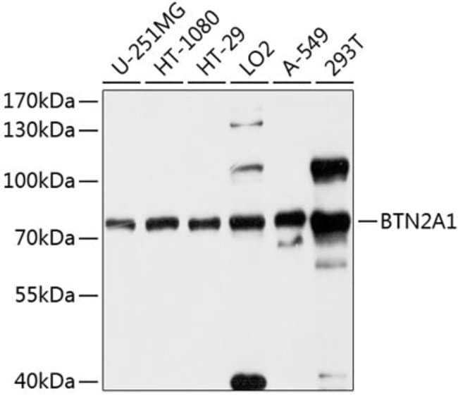 100UL BTN2A1 ANTIBODY 100 ul
