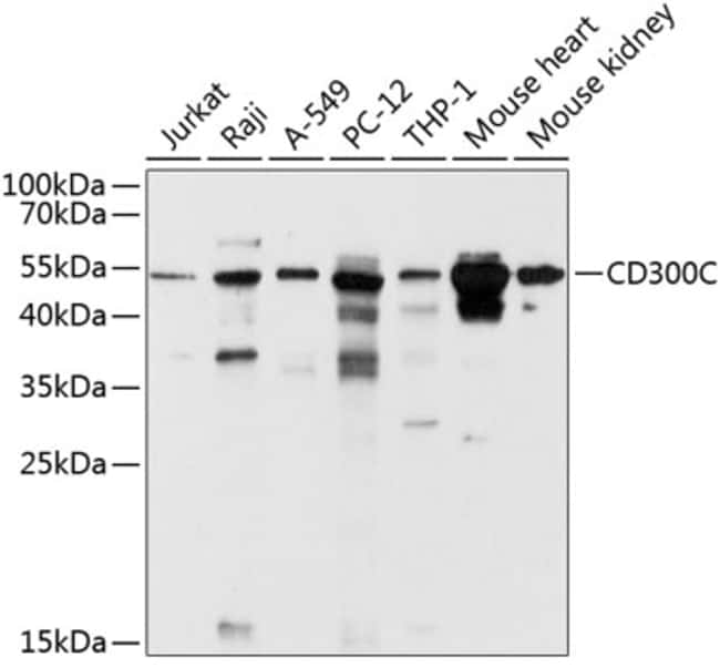100UL CD300C ANTIBODY 100 ul