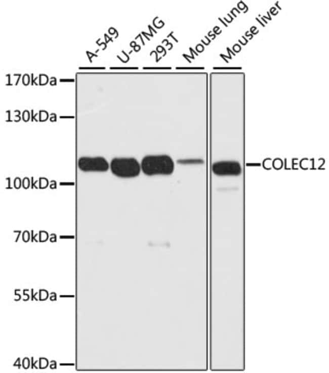 100UL COLEC12 ANTIBODY 100 ul