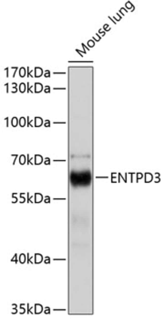 100UL ENTPD3 ANTIBODY 100 ul