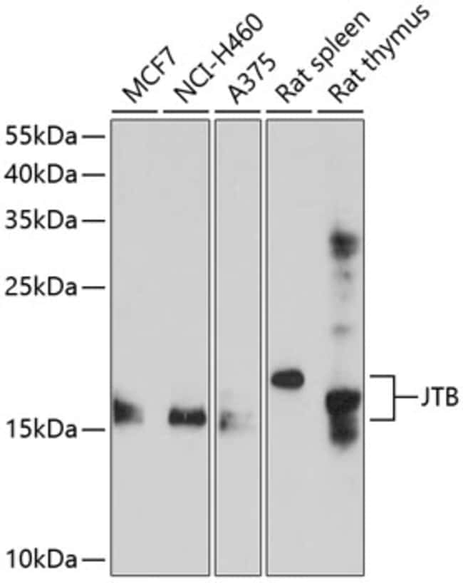 100UL JTB ANTIBODY 100 ul