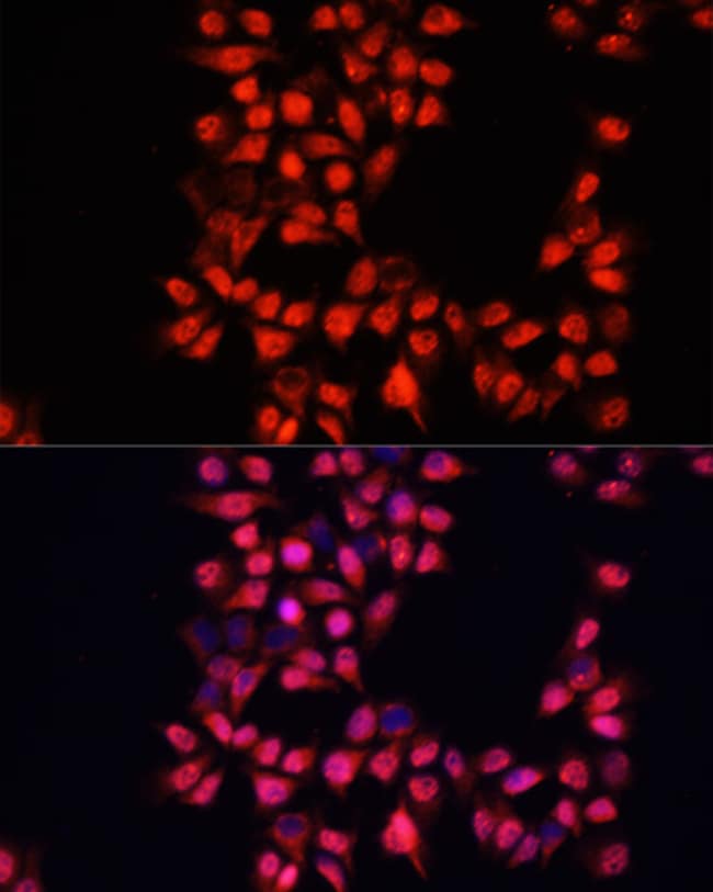 100UL ADAM10 ANTIBODY 100 ul