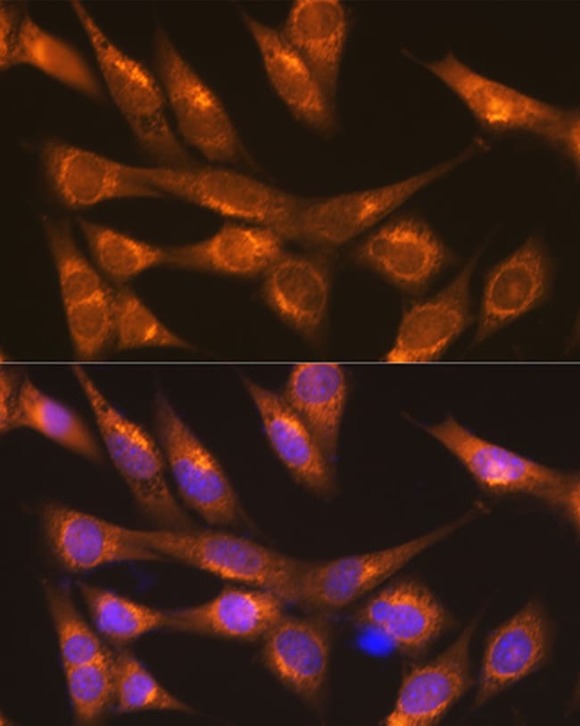 100UL LMAN1 ANTIBODY 100 ul
