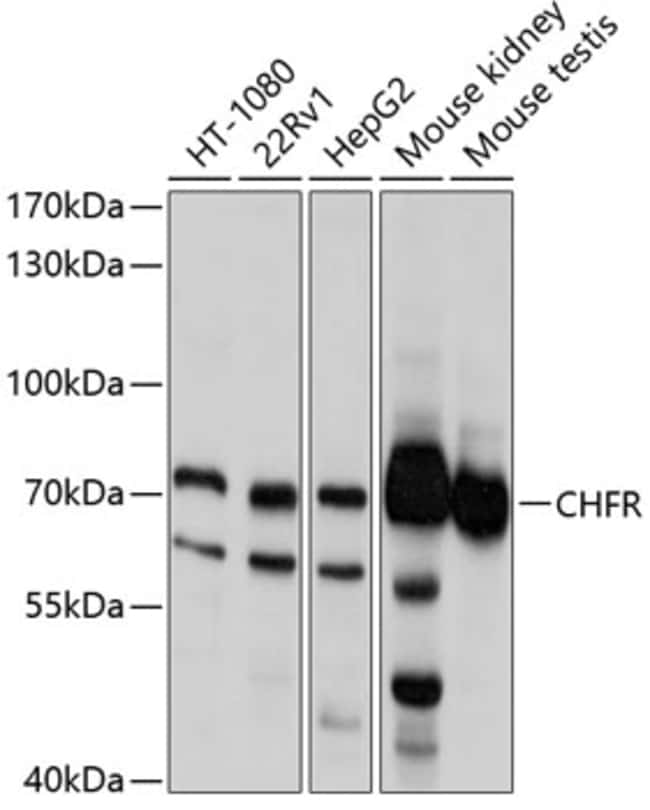 100UL CHFR ANTIBODY 100 ul