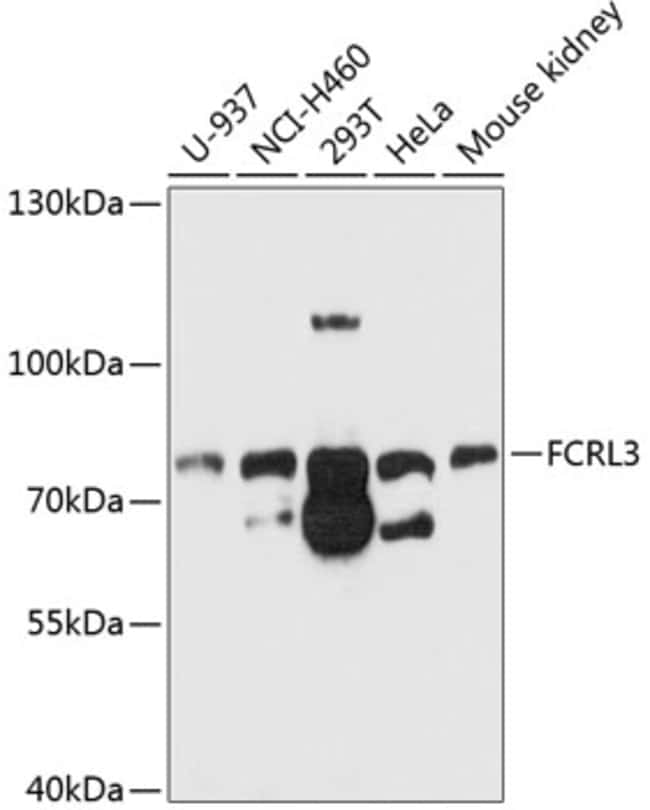 100UL FCRL3 ANTIBODY 100 ul
