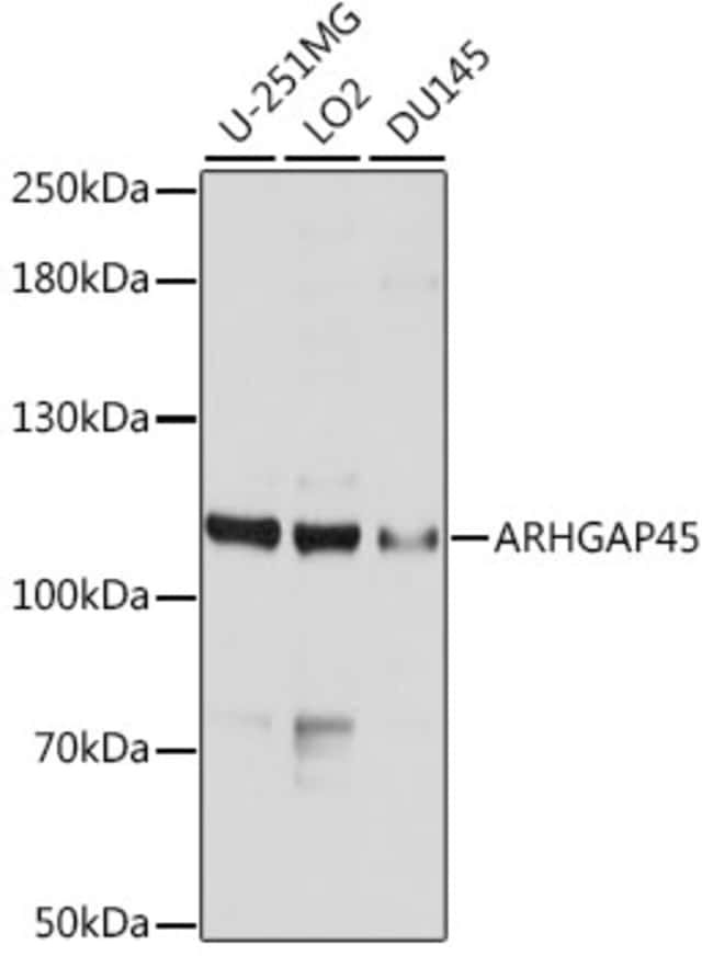 100UL HMHA1 ANTIBODY 100 ul