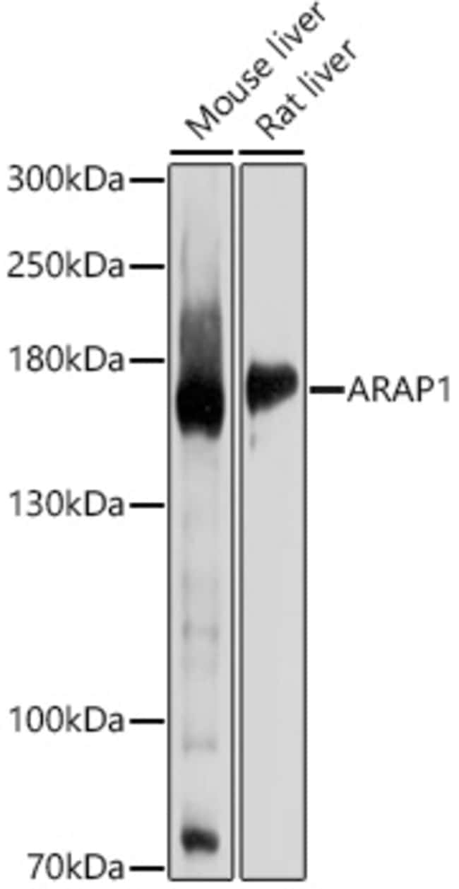 100UL ARAP1 ANTIBODY 100 ul