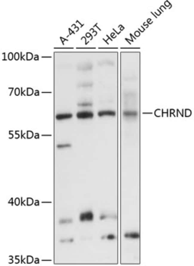 100UL CHRND ANTIBODY 100 ul