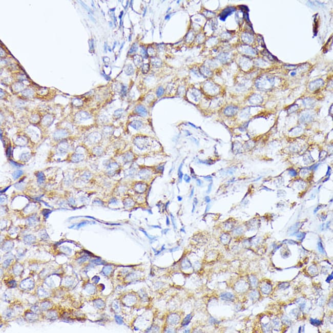 100UL CATHEPSIN F ANTIBODY 100 ul