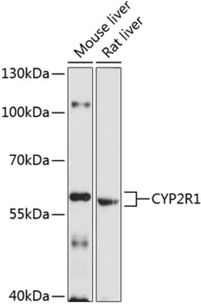 100UL CYP2R1 ANTIBODY 100 ul
