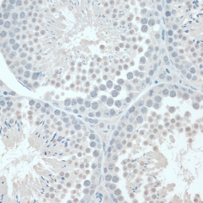 100UL GAPDHS ANTIBODY 100 ul