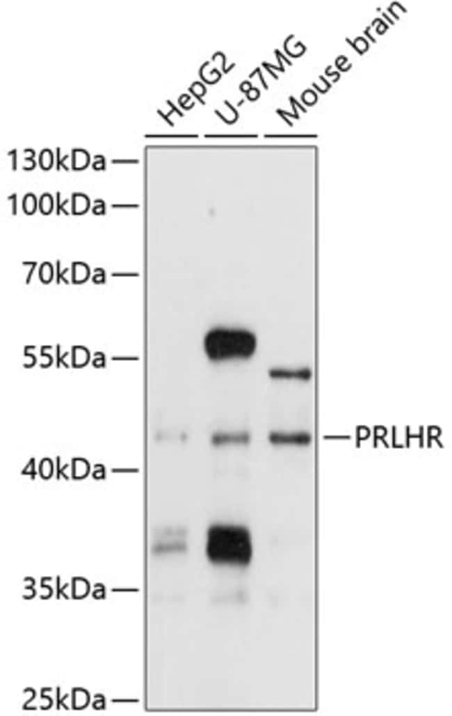 100UL GPR10 ANTIBODY 100 ul