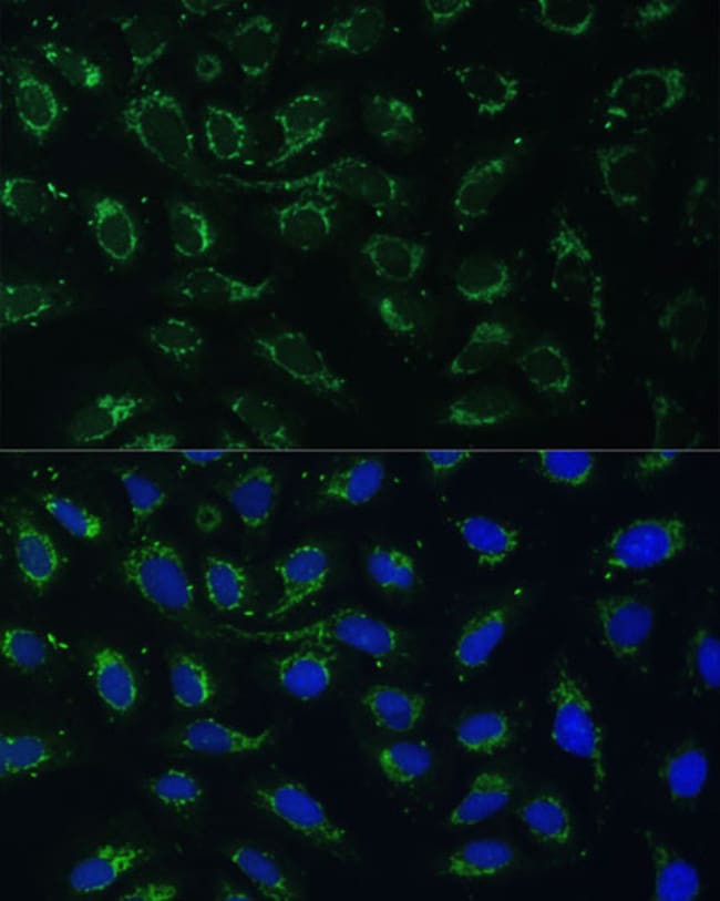 100UL AKR1C2 ANTIBODY 100 ul