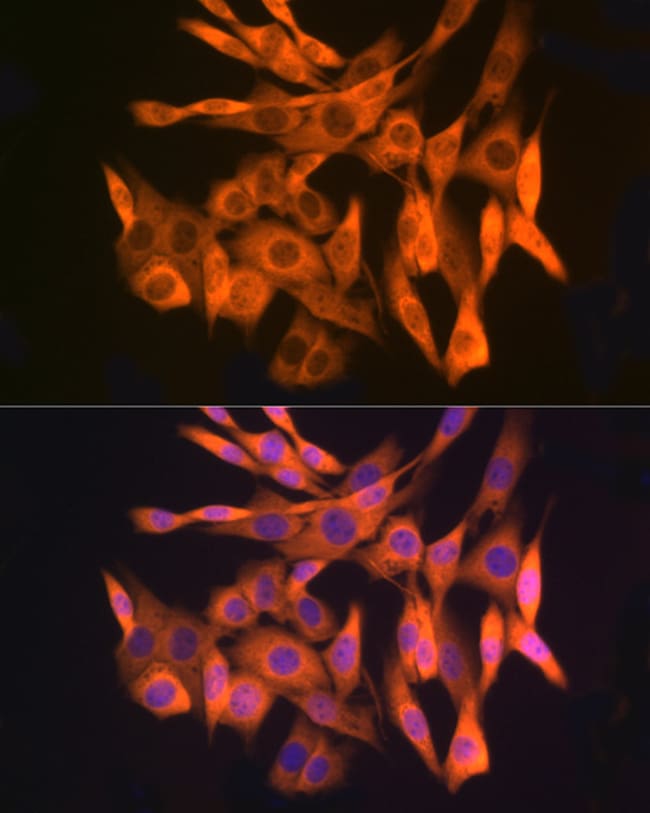 100UL AGPS ANTIBODY 100 ul
