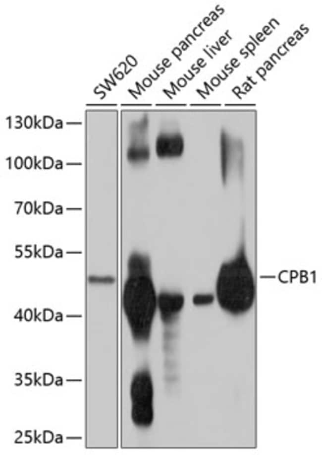 100UL CARBOXYPEPTIDASE B1 ANTIBODY 100 u