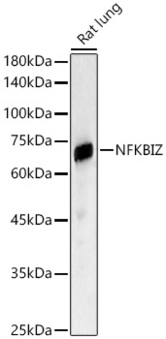 100UL IKB ZETA ANTIBODY 100 ul