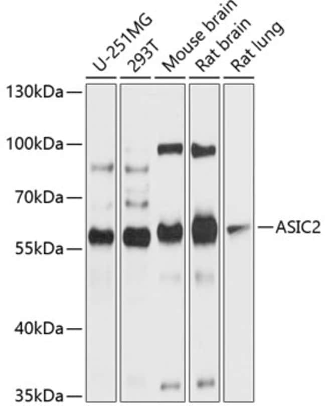 100UL ASIC2 ANTIBODY 100 ul
