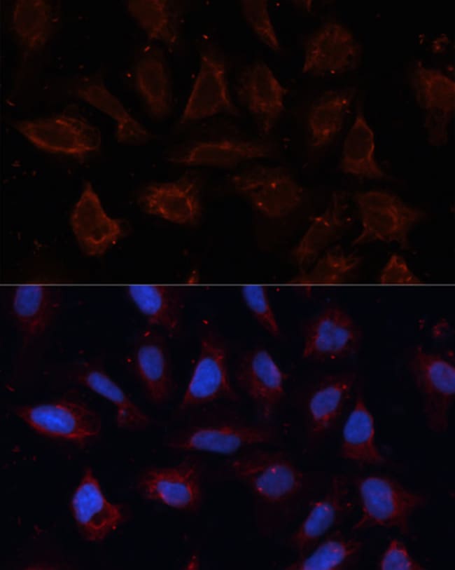 100UL DOG-1 ANTIBODY 100 ul