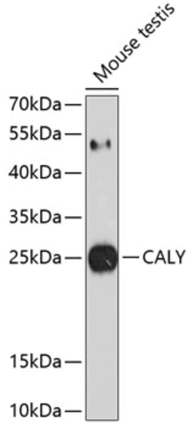 100UL CALY ANTIBODY 100 ul