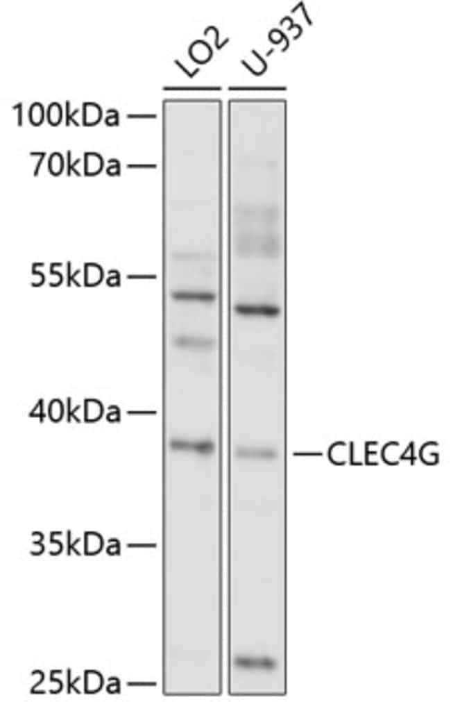 100UL CLEC4G ANTIBODY 100 ul