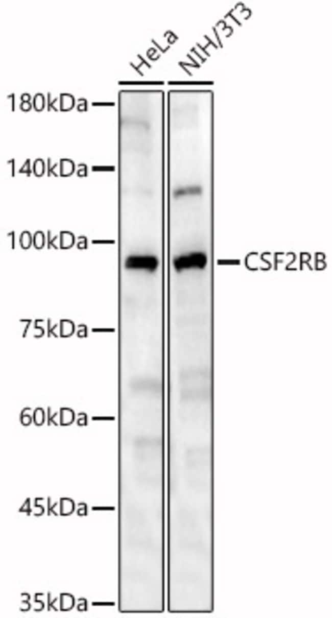 100UL CSF2RB ANTIBODY 100 ul