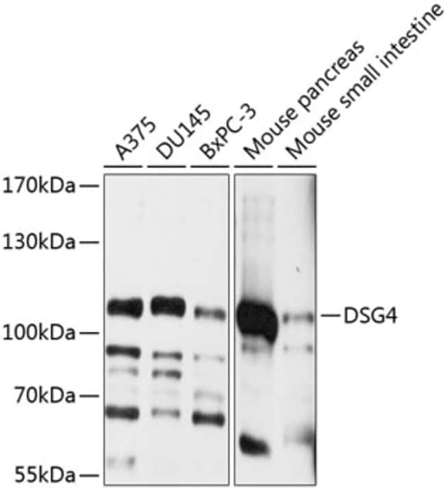 100UL DESMOGLEIN 4 ANTIBODY 100 ul