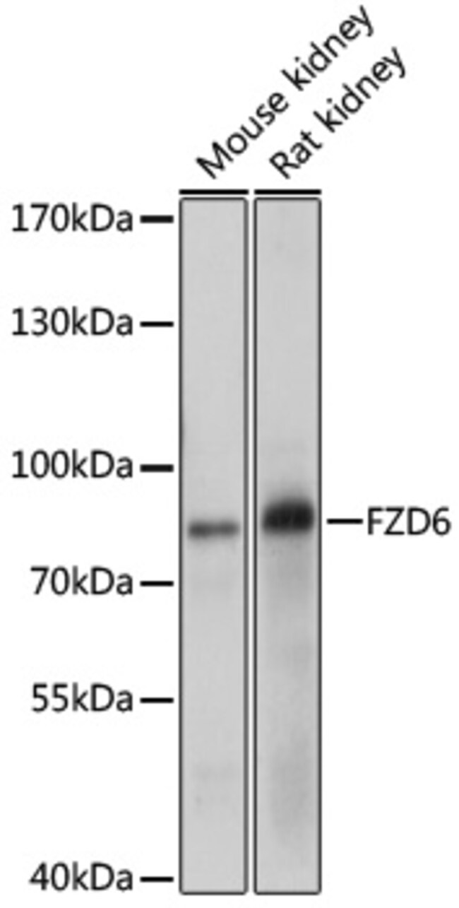 100UL FZD6 ANTIBODY 100 ul