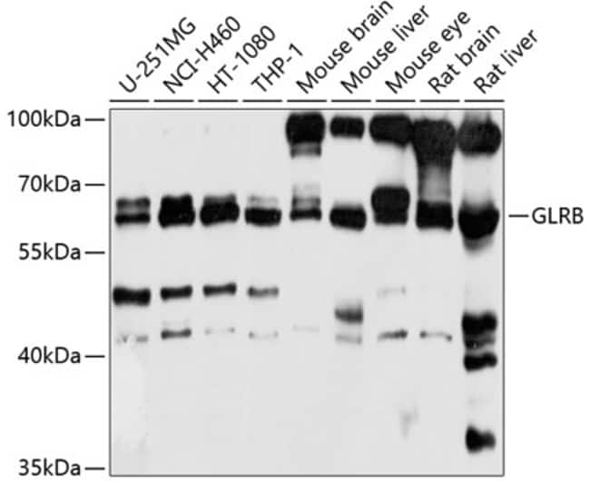 100UL GLRB ANTIBODY 100 ul