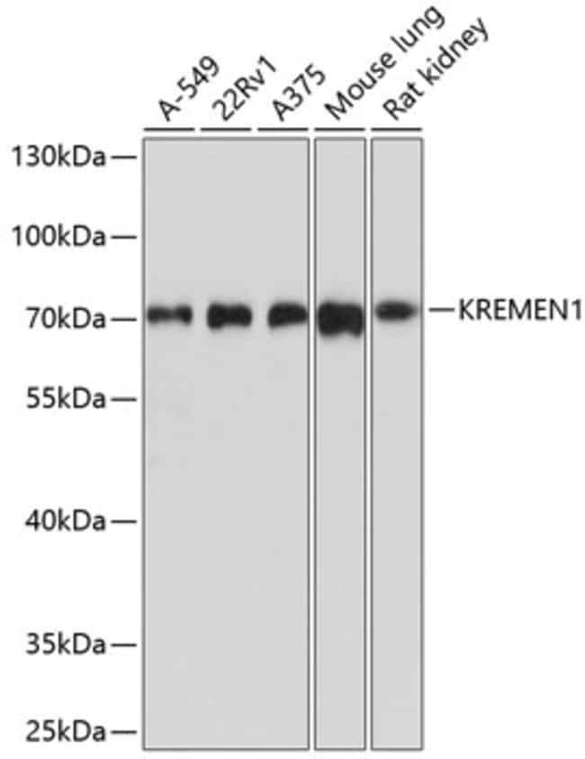 100UL KREMEN1 ANTIBODY 100 ul
