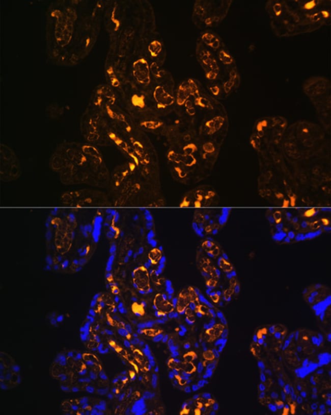 100UL LRP8 ANTIBODY 100 ul