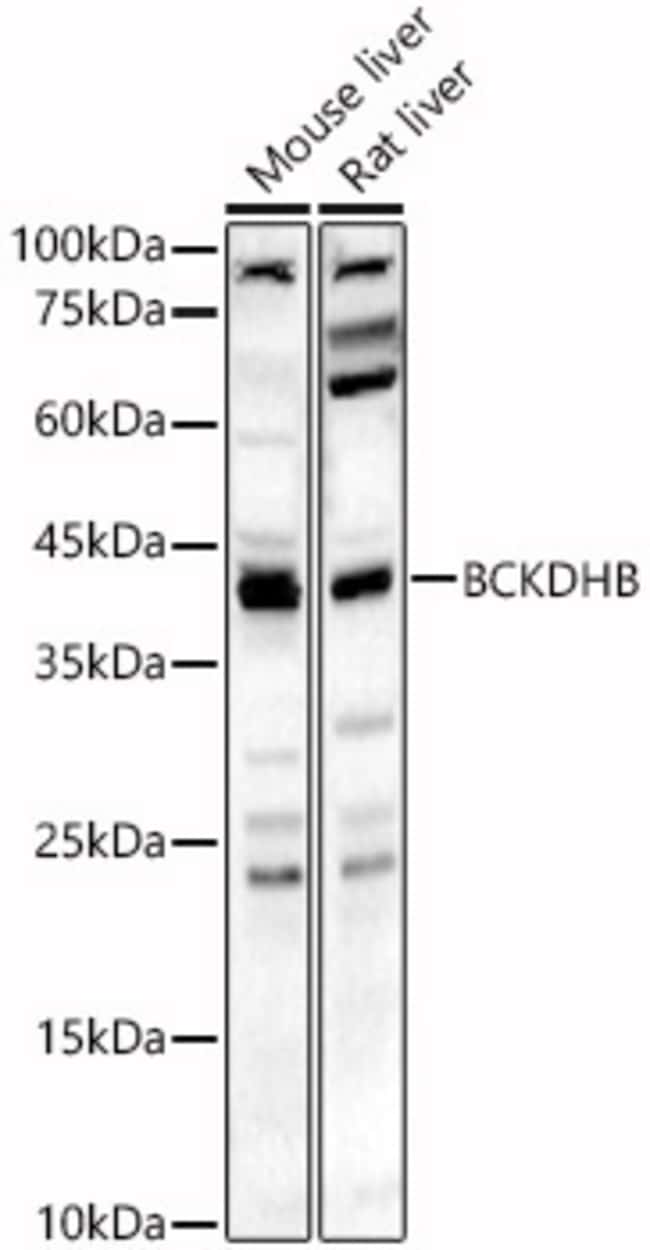 100UL BCKDHB ANTIBODY 100 ul
