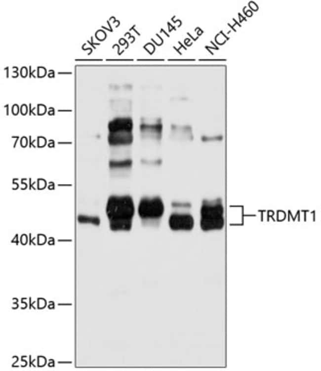 100UL DNMT2 ANTIBODY 100 ul