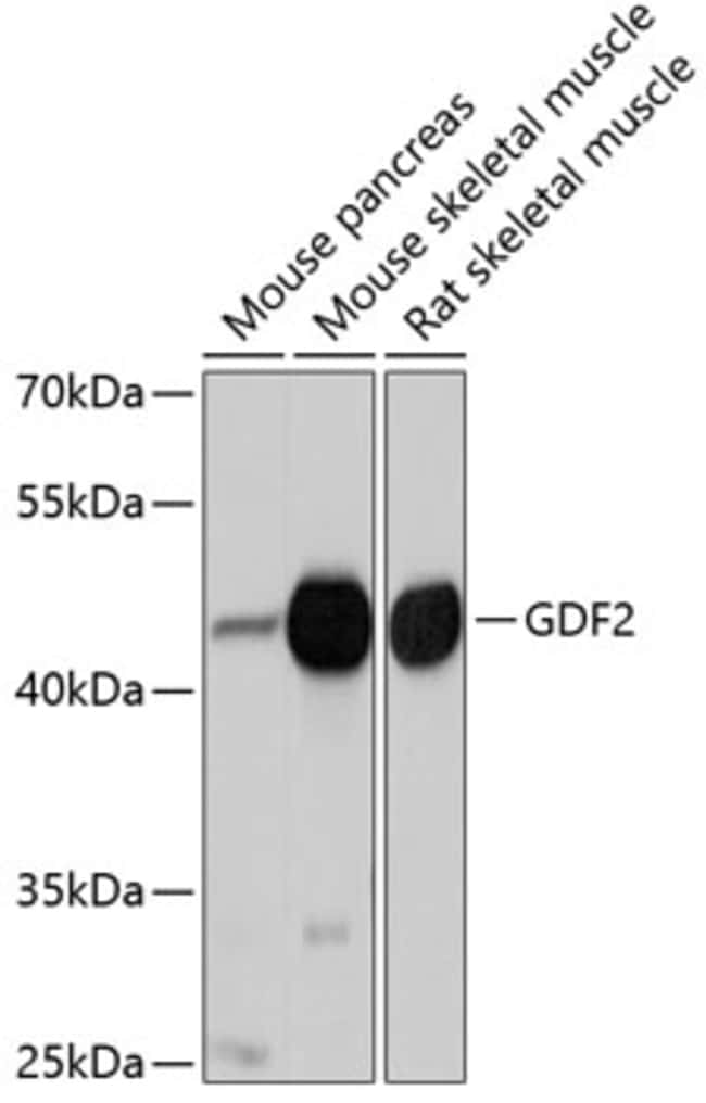 100UL BMP9 ANTIBODY 100 ul