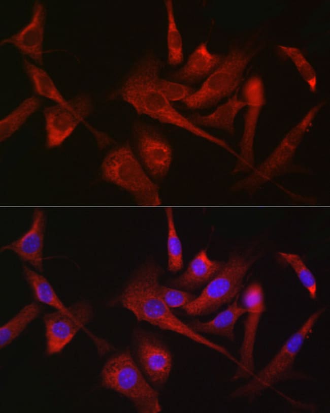 100UL HK1 ANTIBODY 100 ul