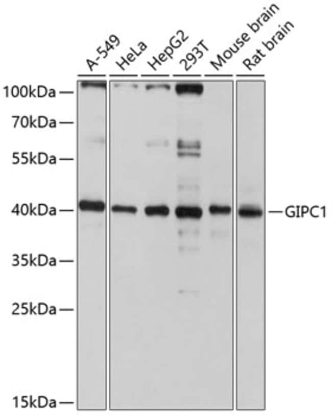 100UL GIPC1 ANTIBODY 100 ul