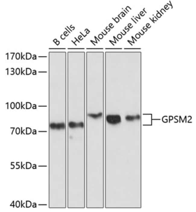 100UL GPSM2 ANTIBODY 100 ul