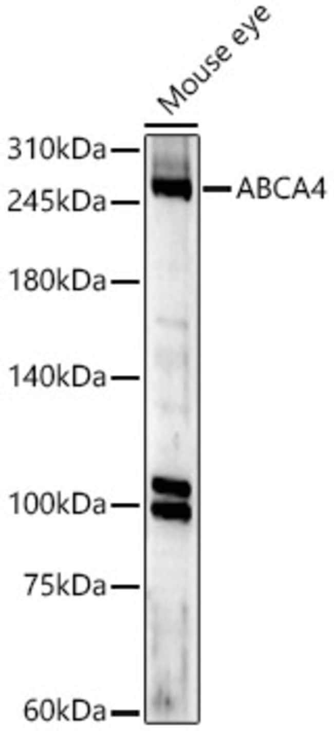 100UL ABCA4 ANTIBODY 100 ul