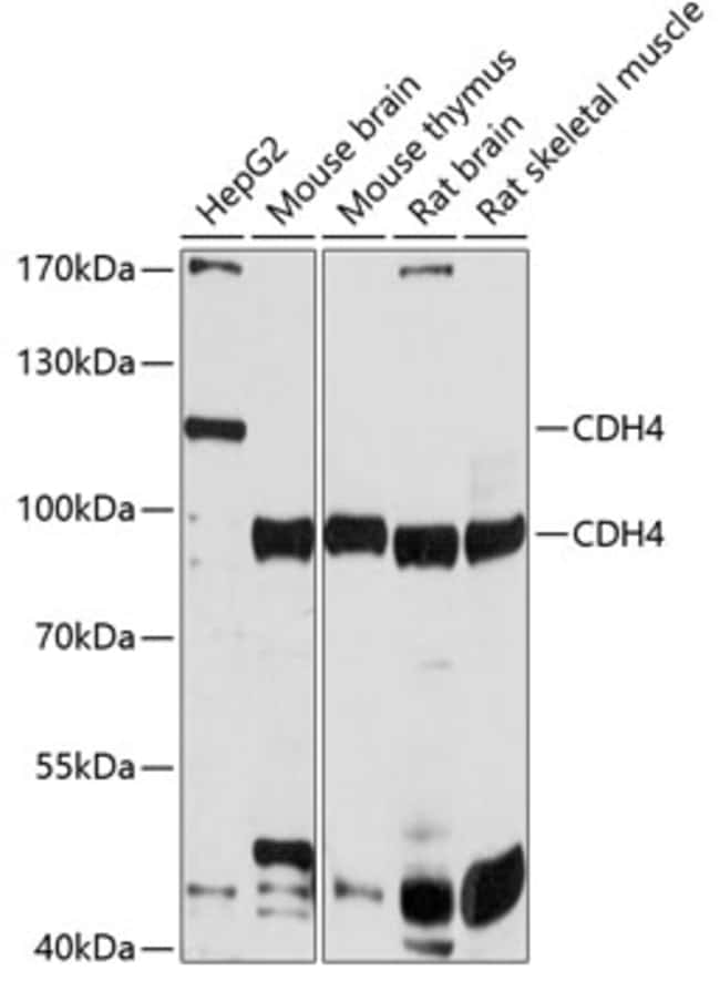 100UL CDH4 ANTIBODY 100 ul