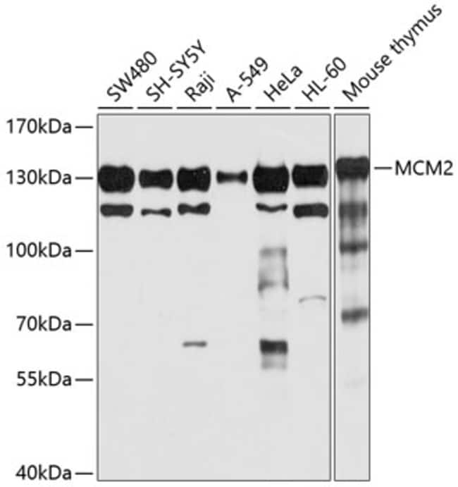 100UL MCM2 ANTIBODY 100 ul