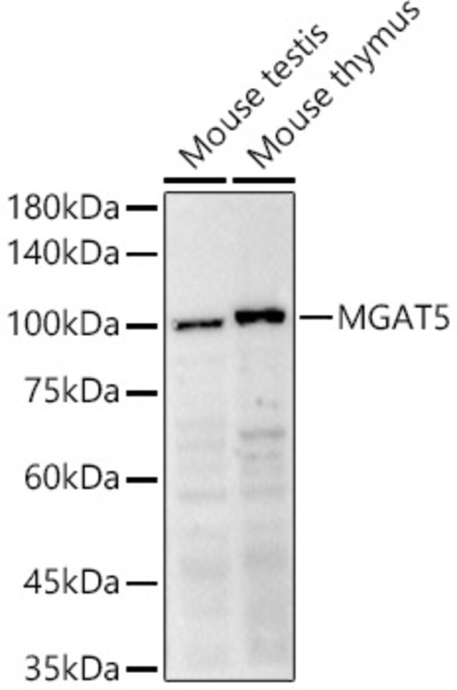 100UL MGAT5 ANTIBODY 100 ul