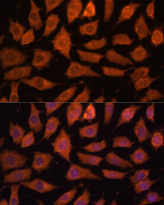 100UL LGMN ANTIBODY 100 ul