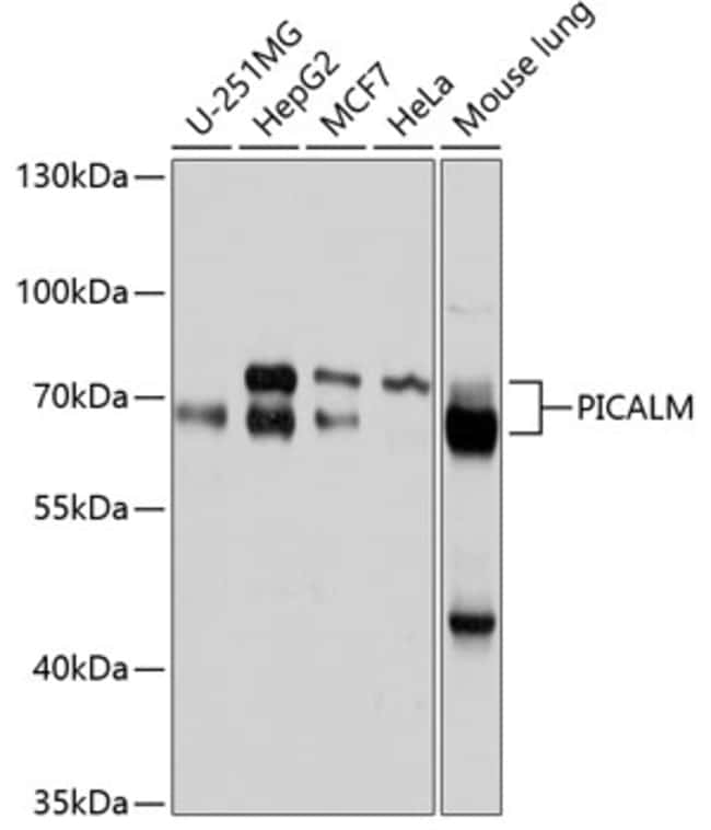 100UL CALM ANTIBODY 100 ul