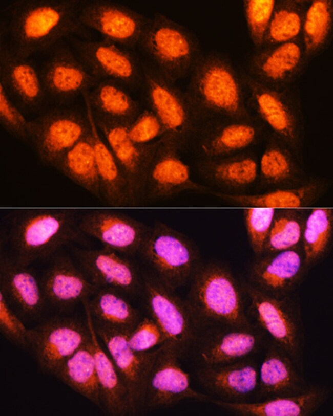 100UL 14-3-3 EPSILON ANTIBODY 100 ul