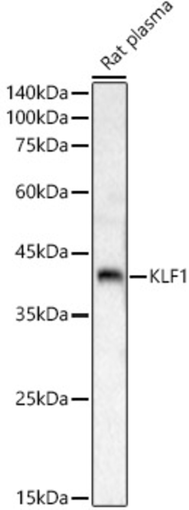 100UL EKLF ANTIBODY 100 ul