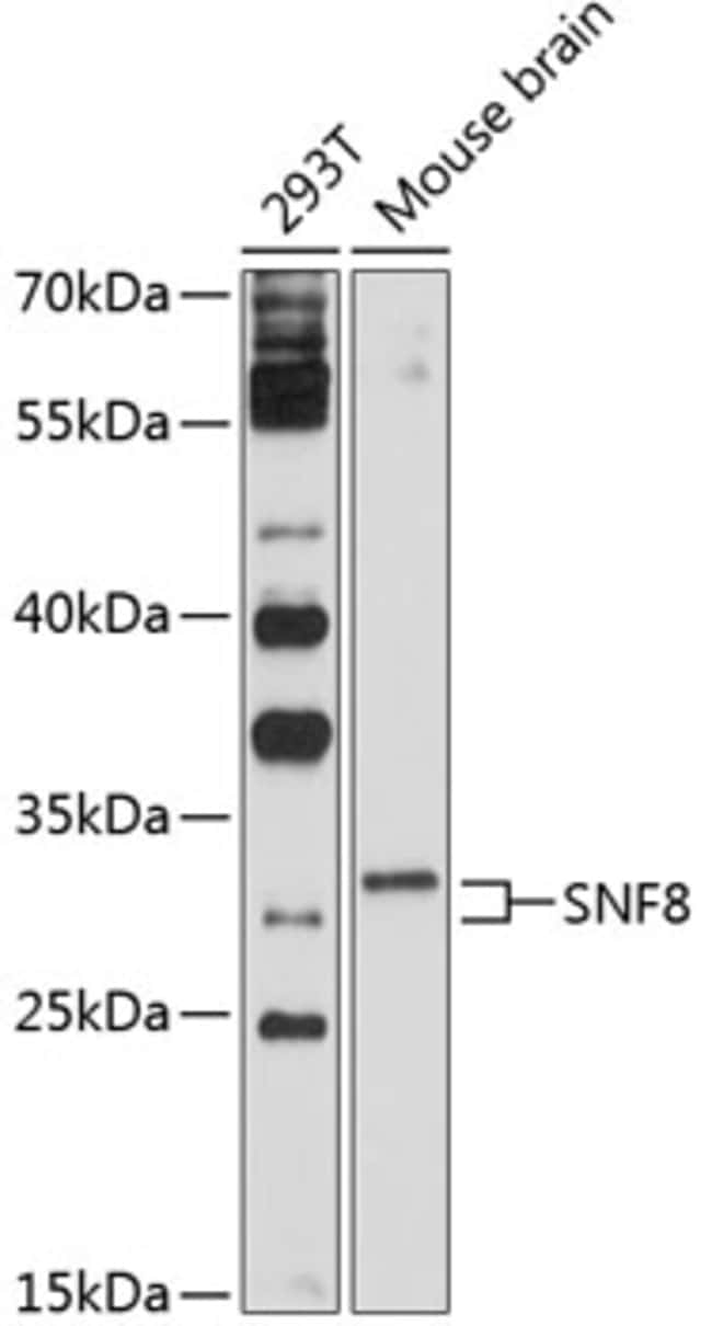 100UL EAP30 ANTIBODY 100 ul