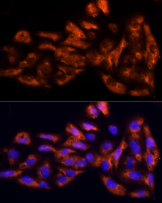 100UL IL17C ANTIBODY 100 ul