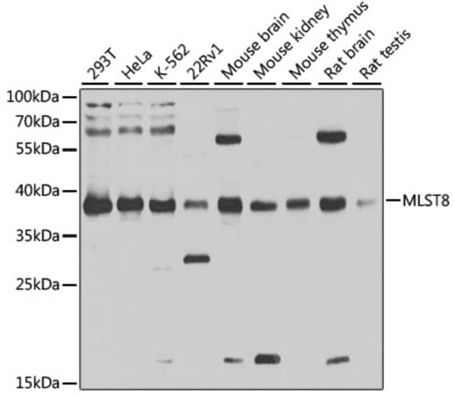 100UL GBL ANTIBODY 100 ul
