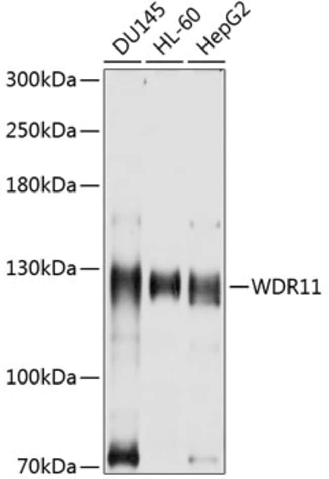 100UL BRWD2 ANTIBODY 100 ul